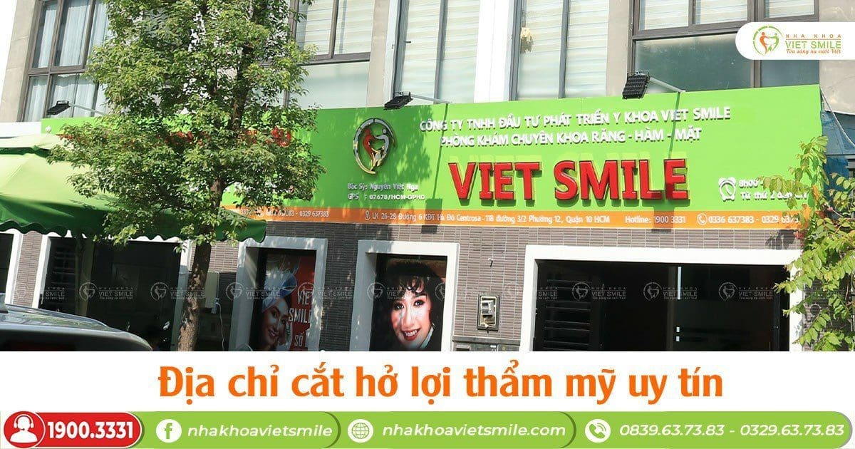Nha khoa Viet Smile - Địa chỉ cắt hở lợi thẩm mỹ uy tín