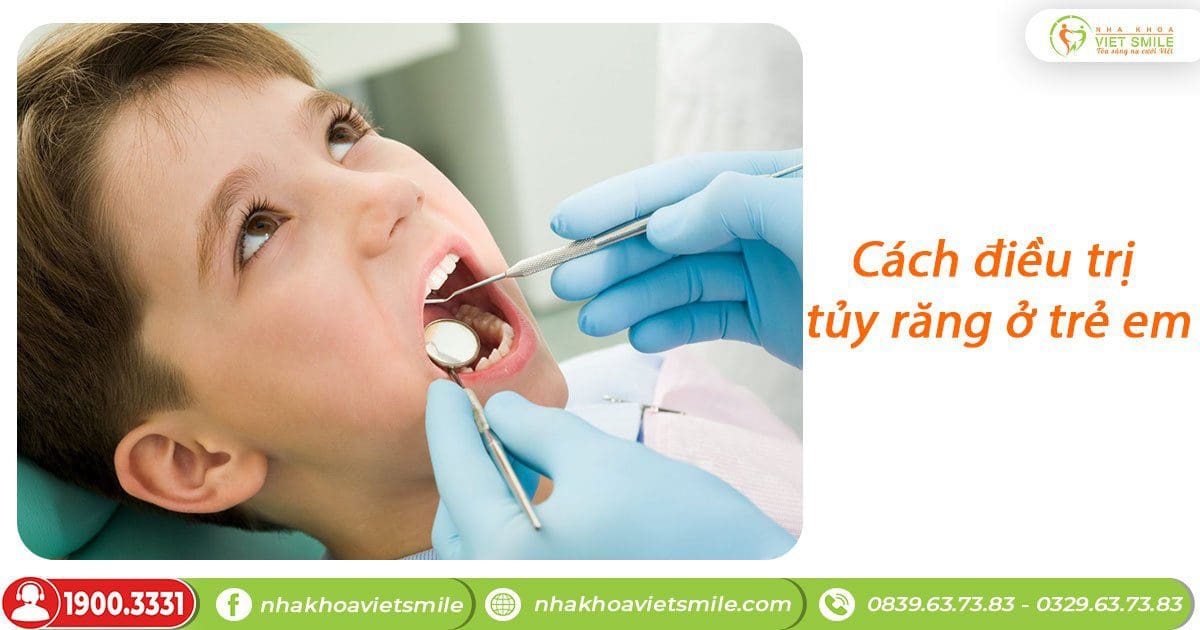 Cách điều trị tủy răng ở trẻ em 