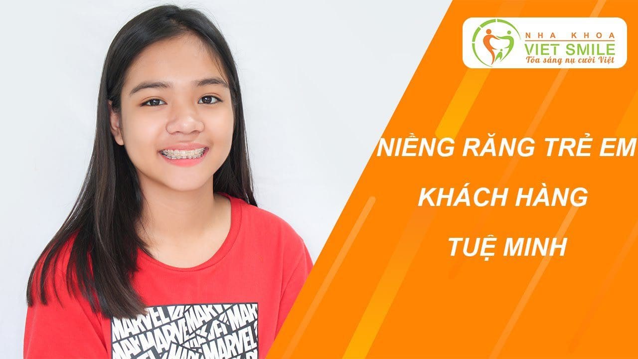 Nha khoa VIET SMILE