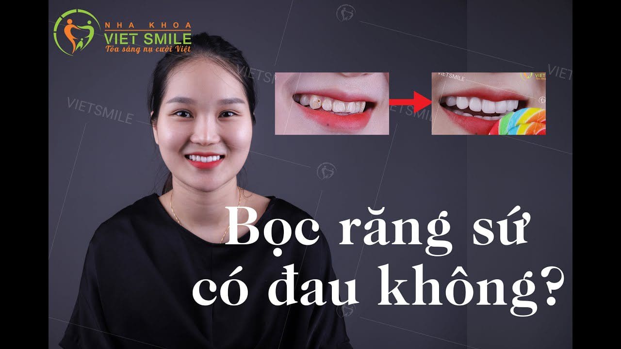 Nha khoa VIET SMILE