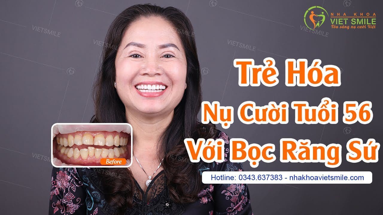 Nha khoa VIET SMILE