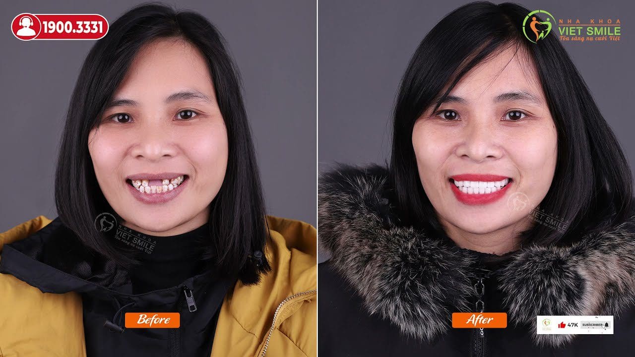 Nha khoa VIET SMILE