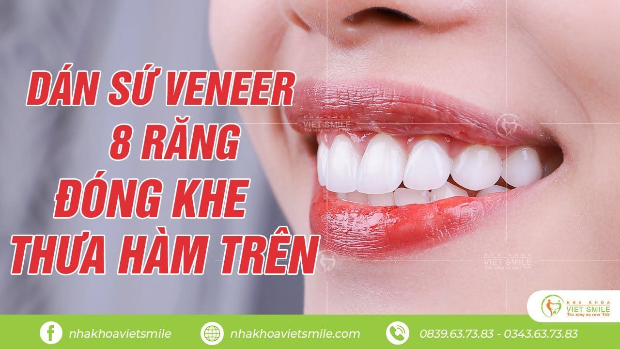 Nha khoa VIET SMILE