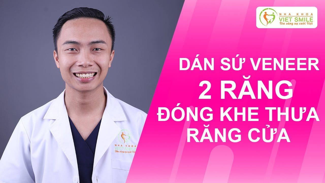 Nha khoa VIET SMILE