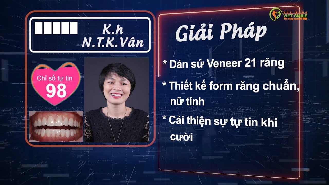 Nha khoa VIET SMILE