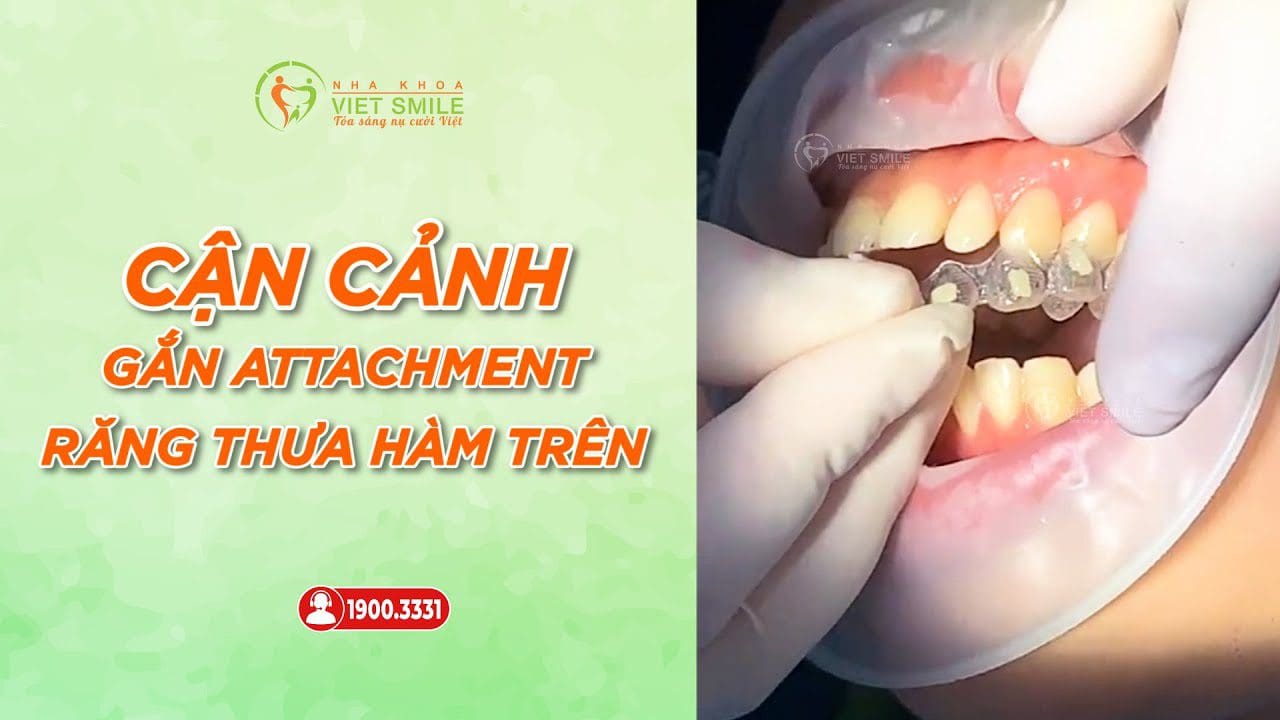 Nha khoa VIET SMILE
