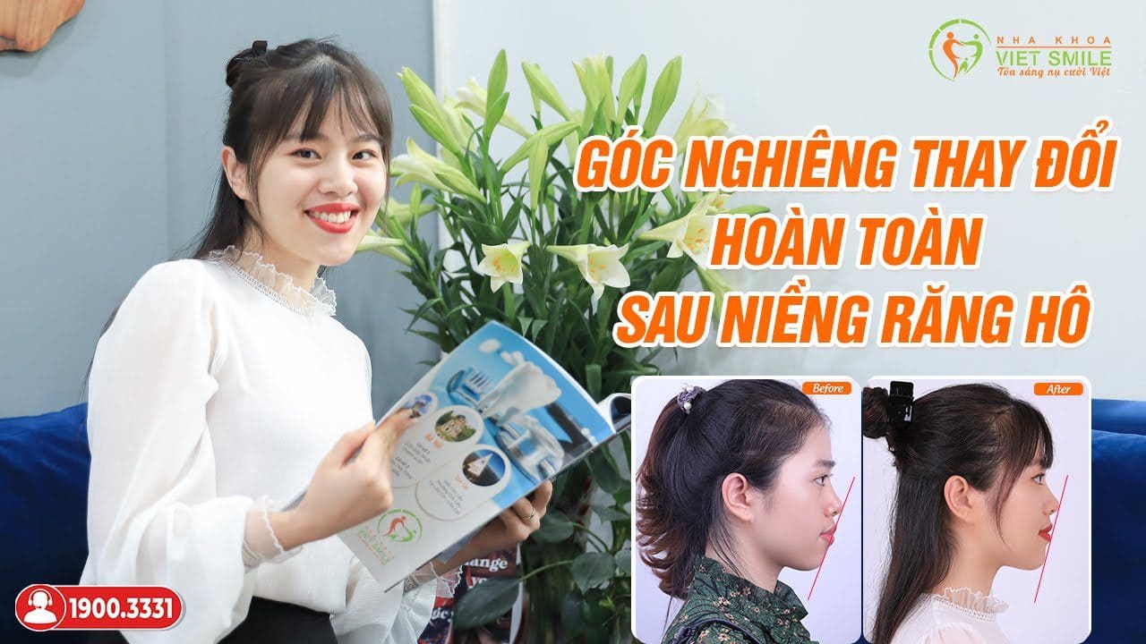 Nha khoa VIET SMILE