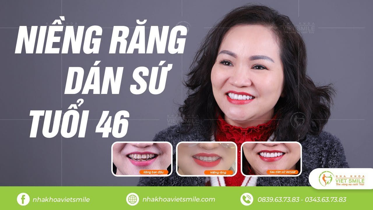 Nha khoa VIET SMILE
