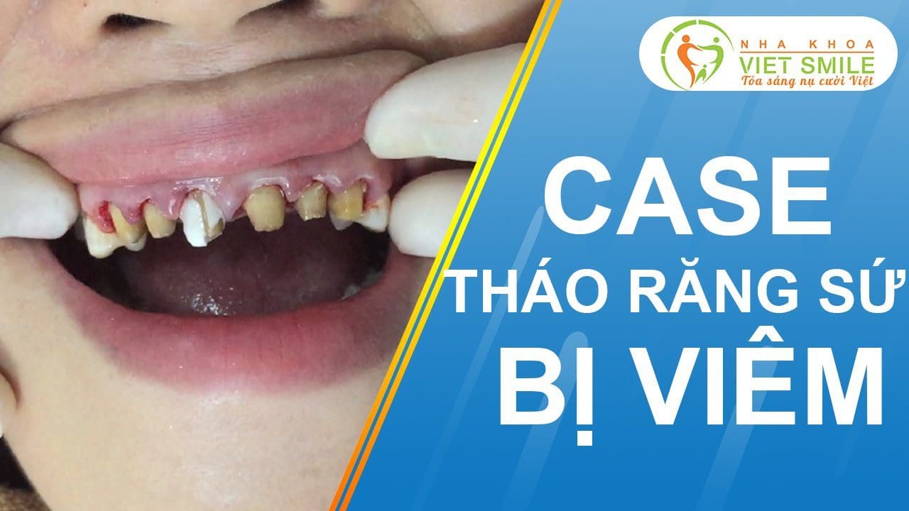 Nha khoa VIET SMILE