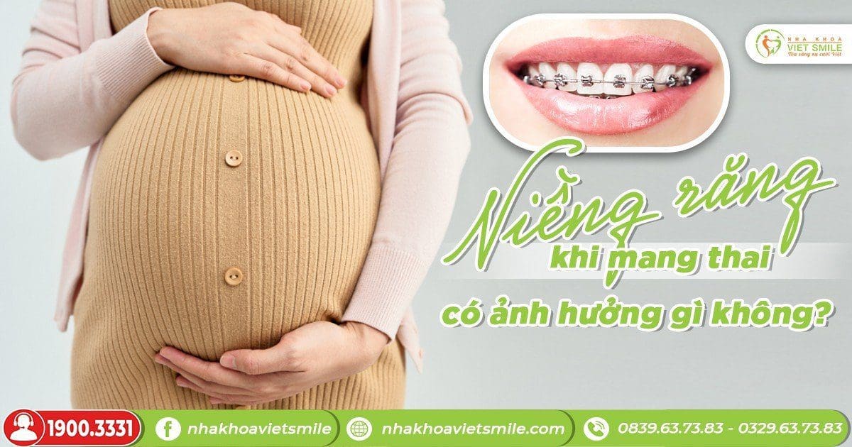 Niềng răng khi mang thai có ảnh hưởng gì không?
