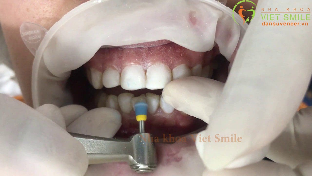 Nha khoa VIET SMILE