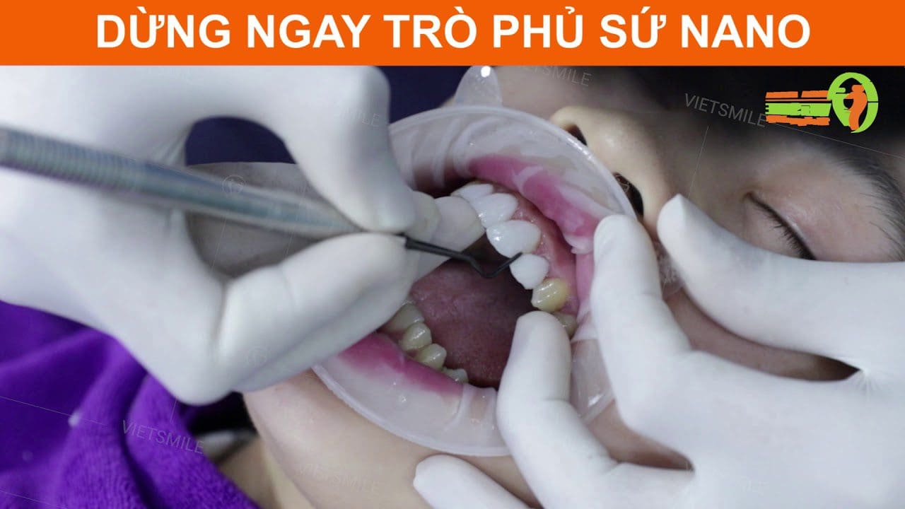 Nha khoa VIET SMILE