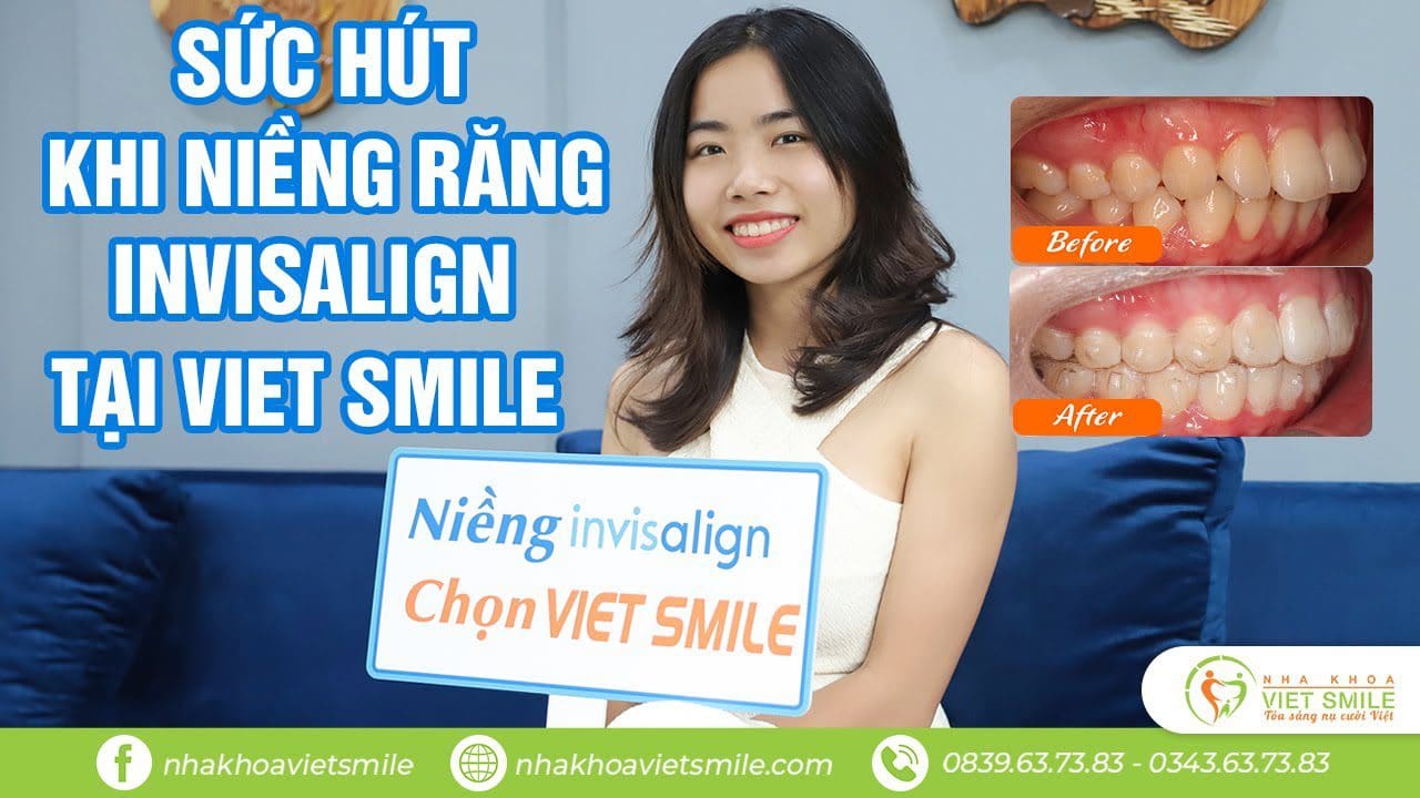 Nha khoa VIET SMILE