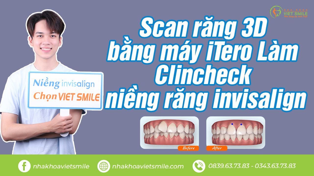 Nha khoa VIET SMILE
