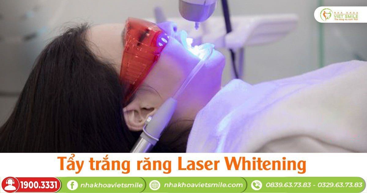 Tẩy trắng răng bao nhiêu tiền bằng công nghệ laser