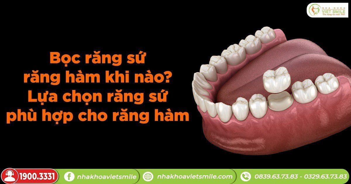 Bọc răng sứ răng hàm khi nào? Lựa chọn răng sứ phù hợp cho răng hàm