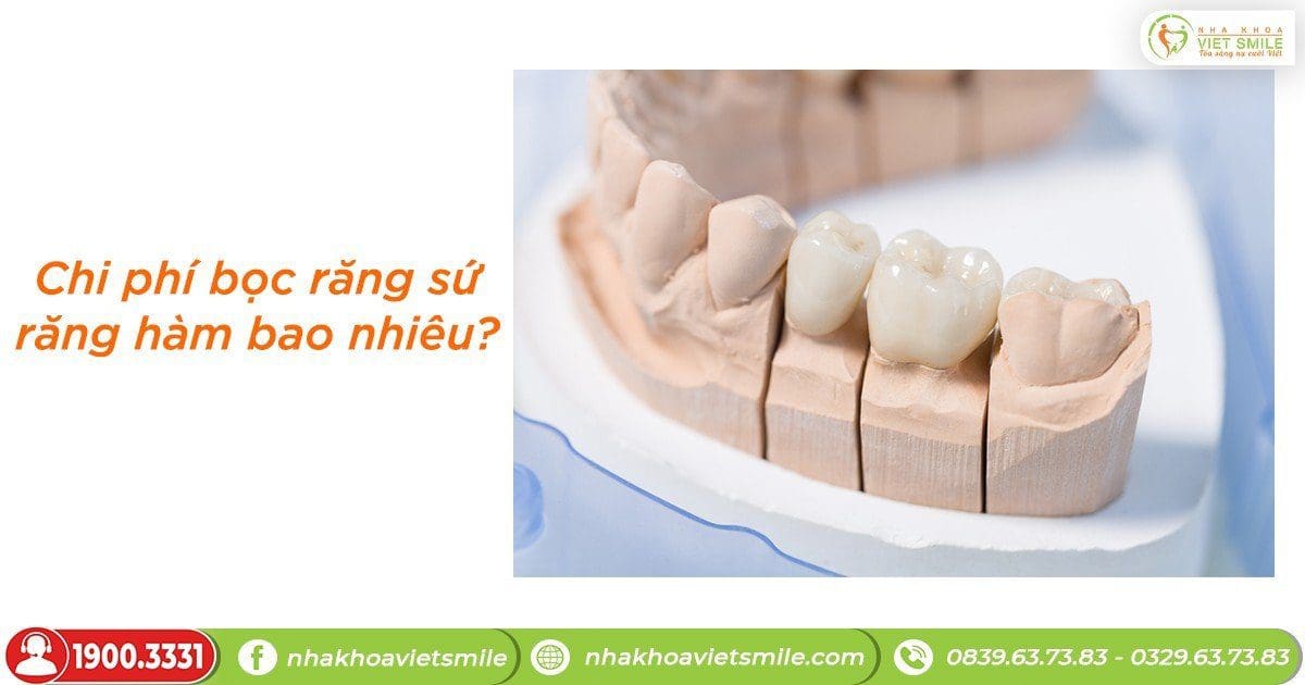 Chi phí bọc răng sứ răng hàm bao nhiêu?