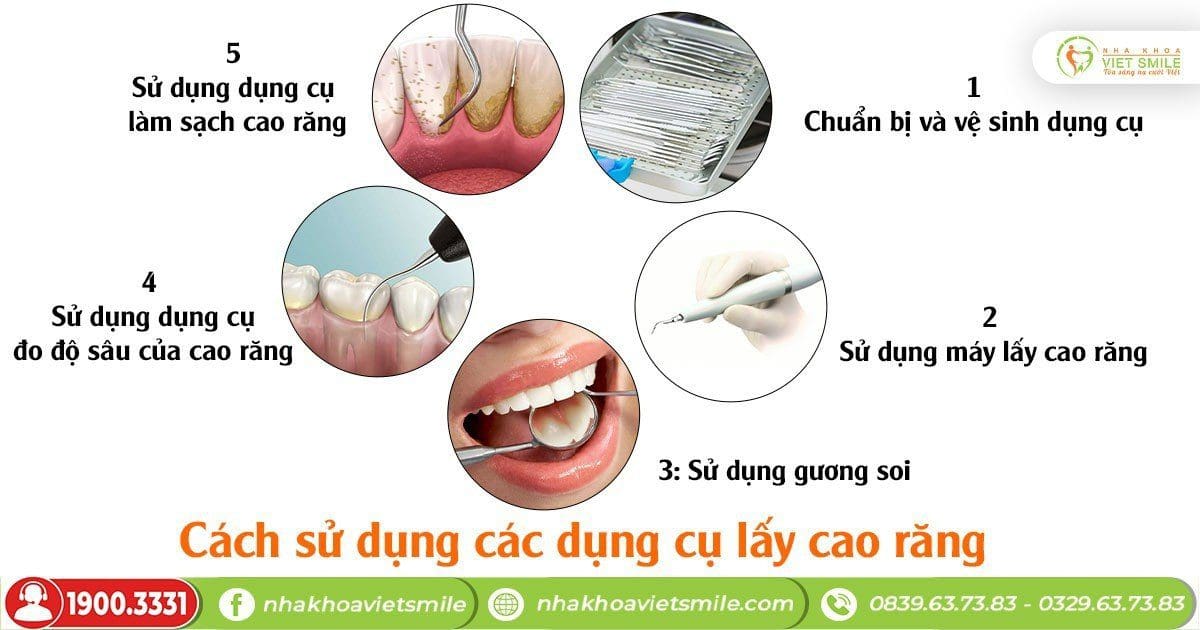 Cách sử dụng các dụng cụ lấy cao răng