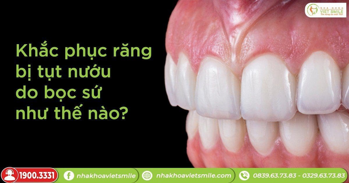 Khắc phục răng bị tụt nướu do bọc sứ như thế nào?