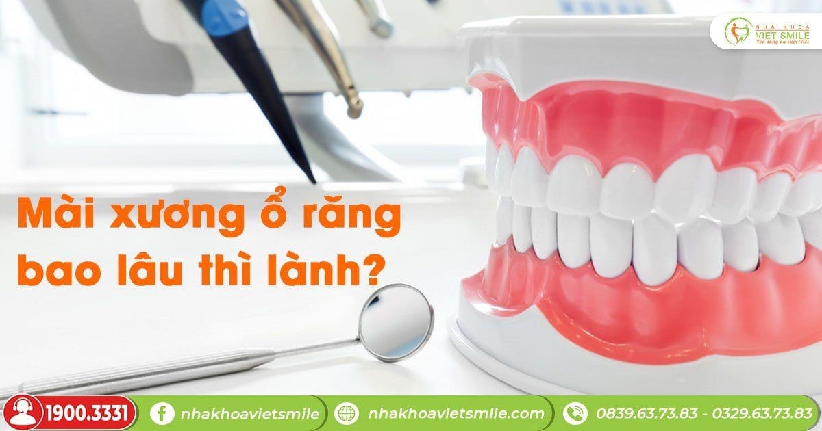 Mài xương ổ răng bao lâu thì lành?