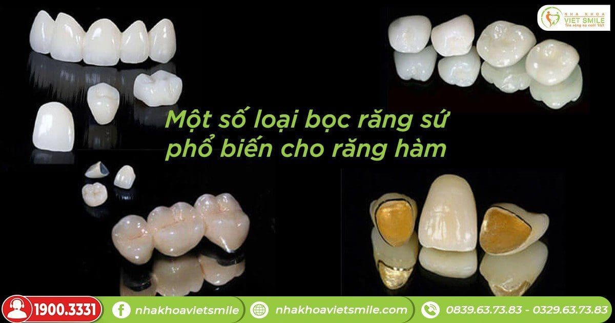 Một số loại bọc răng sứ phổ biến cho răng hàm