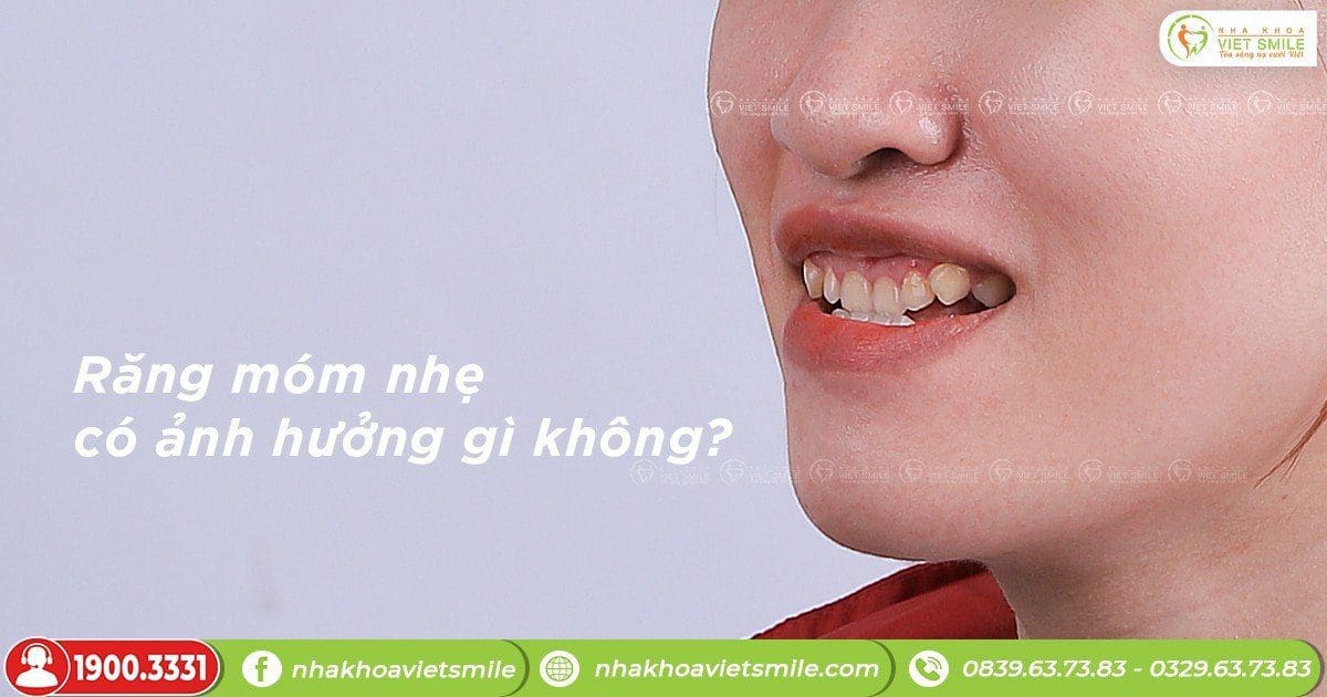 Răng móm nhẹ có ảnh hưởng gì không?