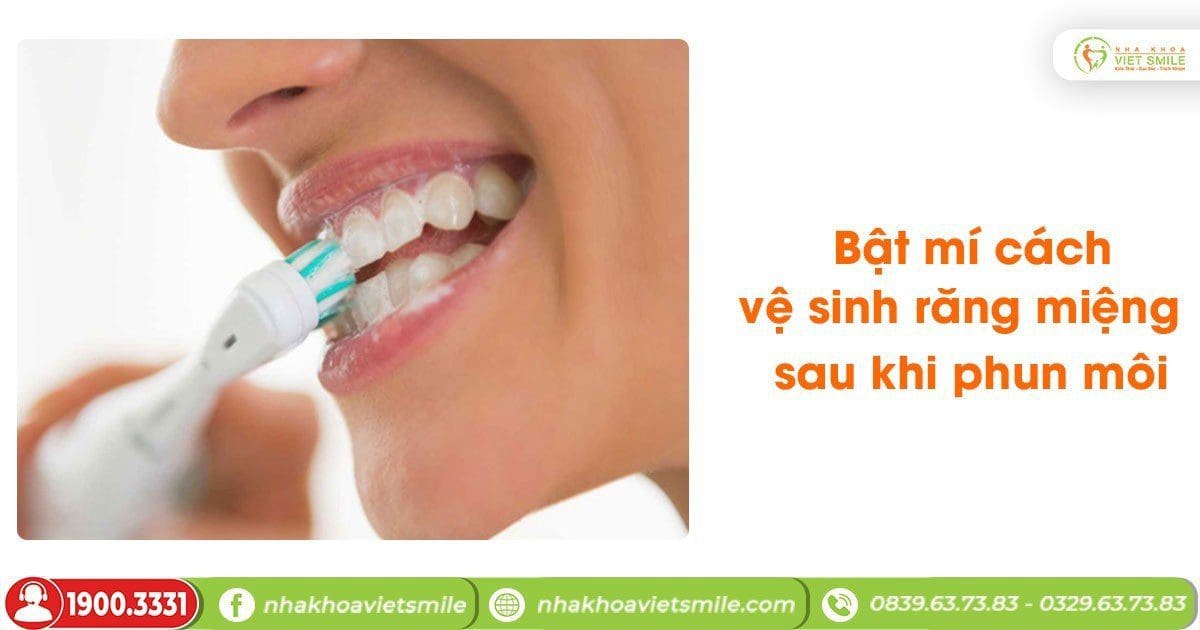 Bật mí cách vệ sinh răng miệng sau khi phun môi