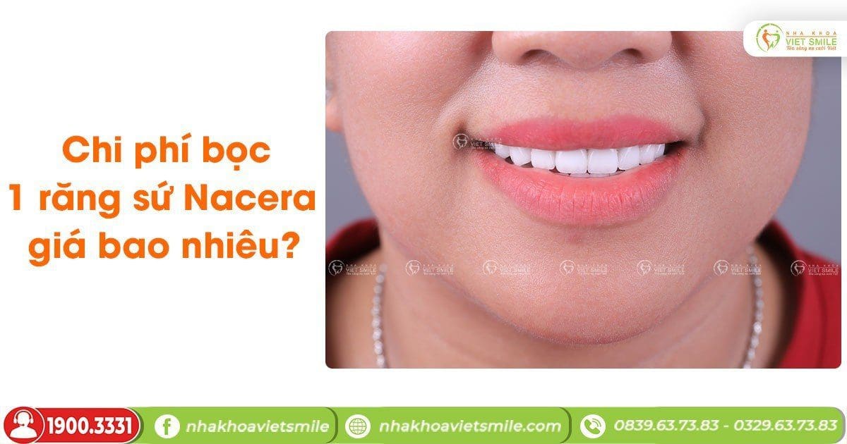 Chi phí bọc 1 răng sứ Nacera giá bao nhiêu?