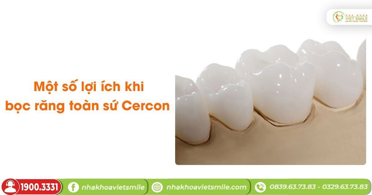 Một số lợi ích khi bọc răng toàn sứ Cercon