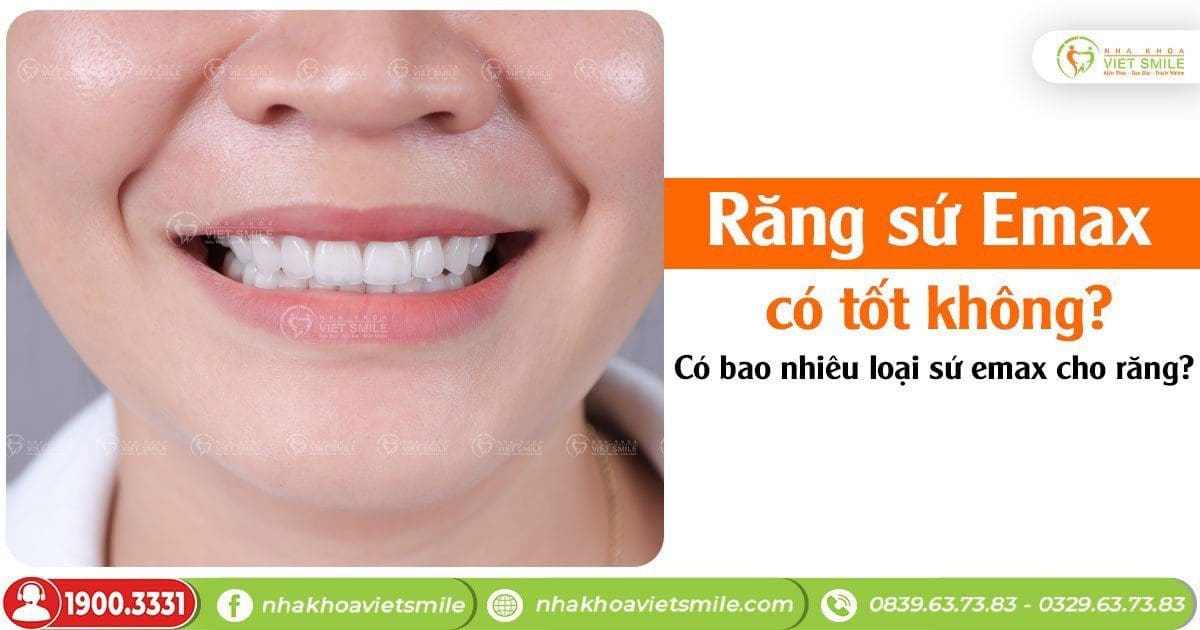 Răng sứ Emax có tốt không? Có bao nhiêu loại sứ emax cho răng?