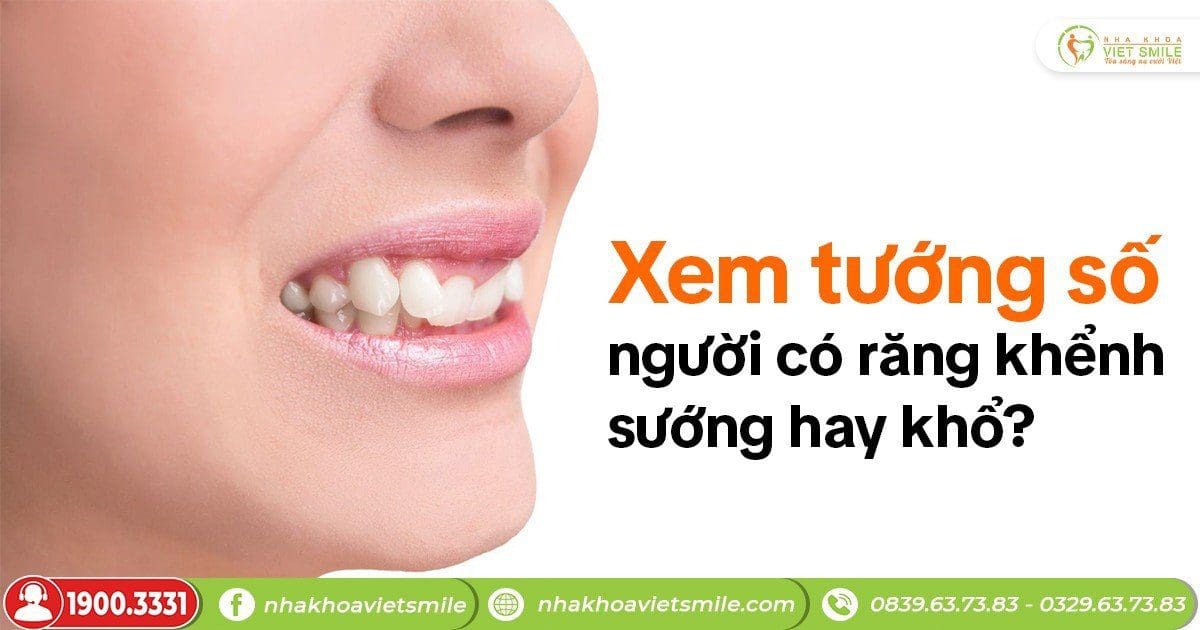 Xem tướng số người có răng khểnh sướng hay khổ?