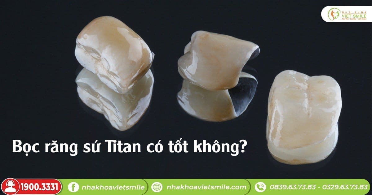 Bọc răng sứ titan có tốt không?