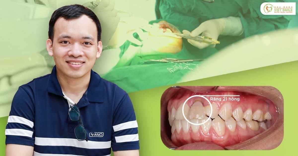 Chọn cấy implant Hàn Quốc trọn gói khắc phục răng cửa hỏng