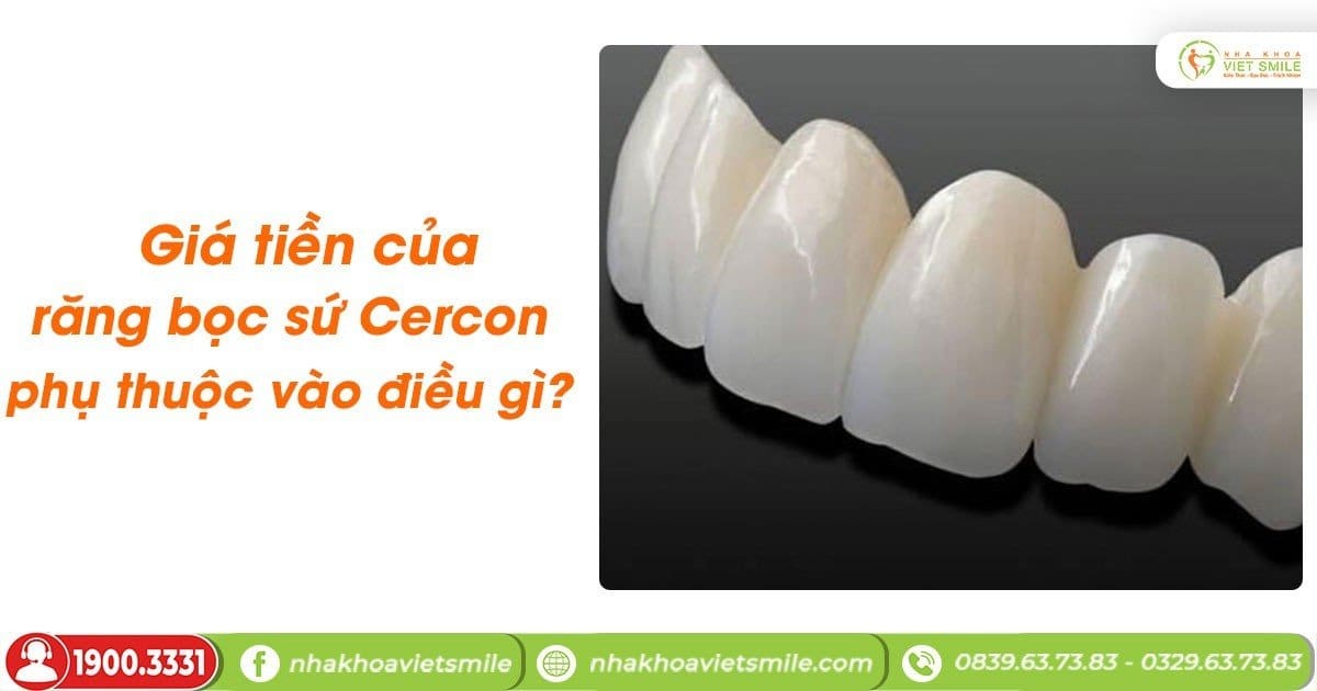 Giá tiền của răng bọc sứ cercon phụ thuộc vào điều gì?