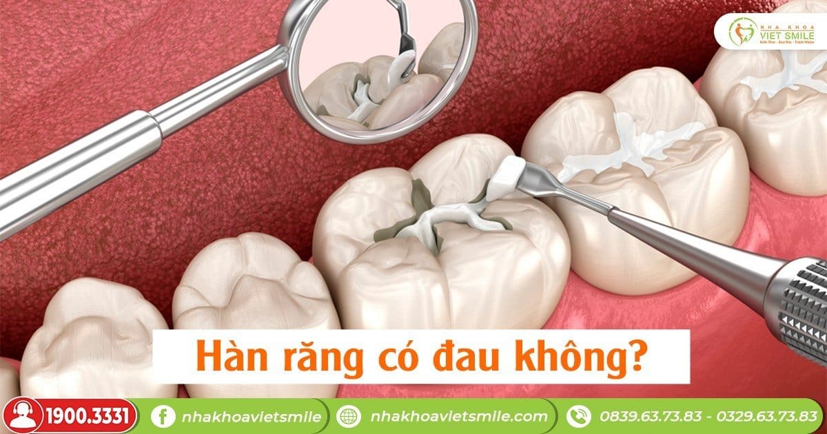 Hàn răng có đau không?