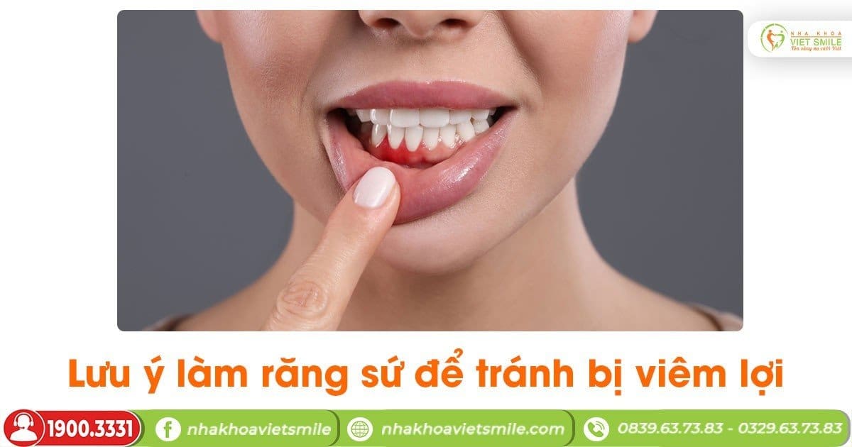 Lưu ý làm răng sứ để tránh bị viêm lợi