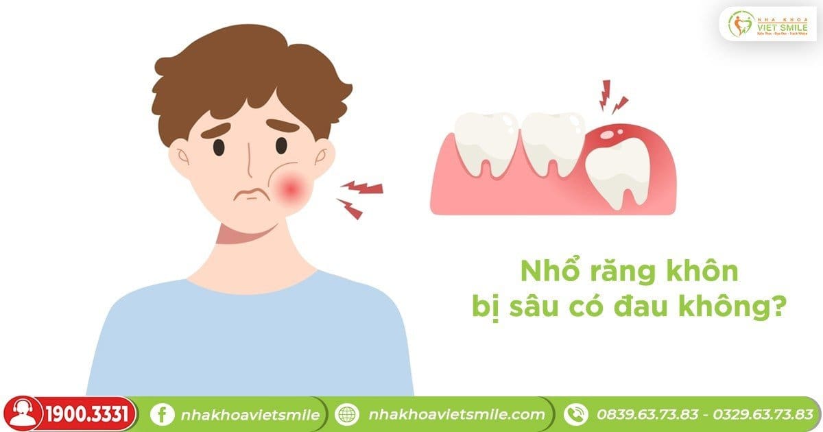 Nhổ răng khôn bị sâu có đau không?