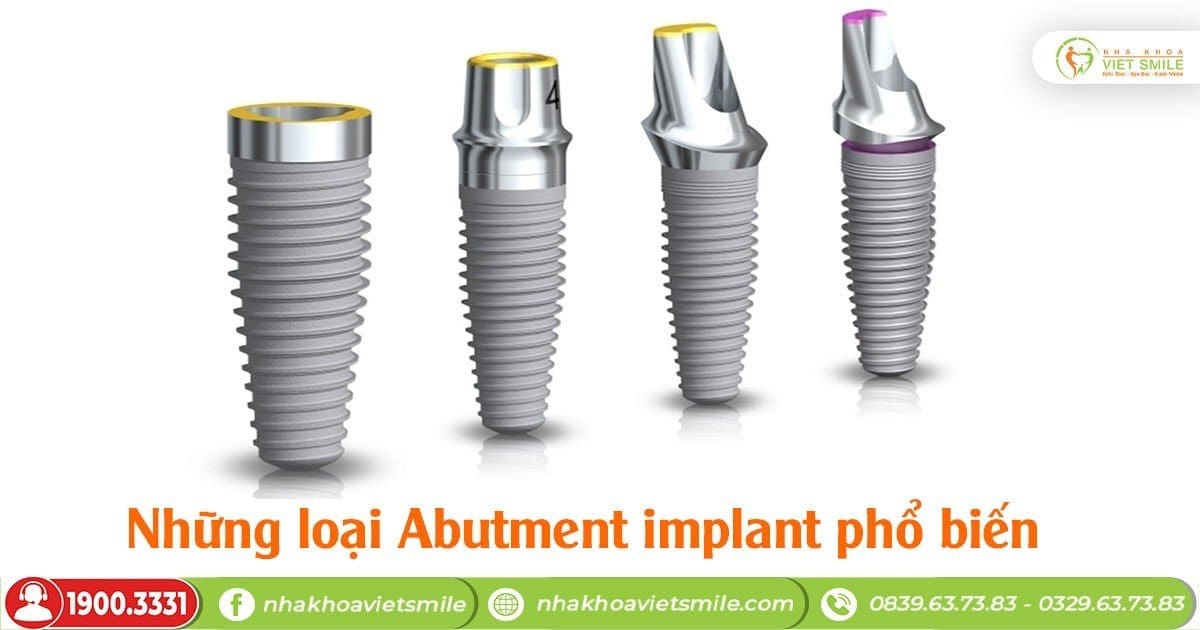 Những loại abutment implant phổ biến