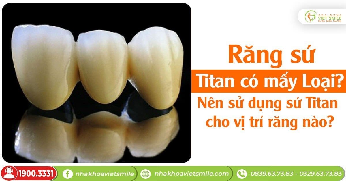 Răng sứ titan có mấy loại? Nên sử dụng sứ titan cho vị trí răng nào?