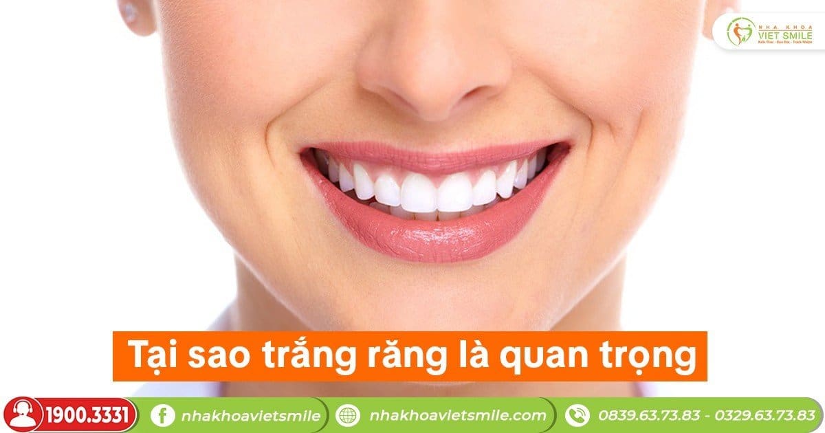 Tại sao trắng răng là quan trọng?