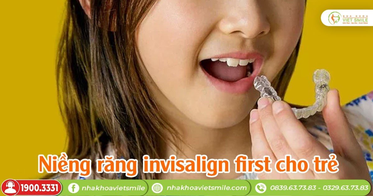 Niềng răng invisalign first cho trẻ