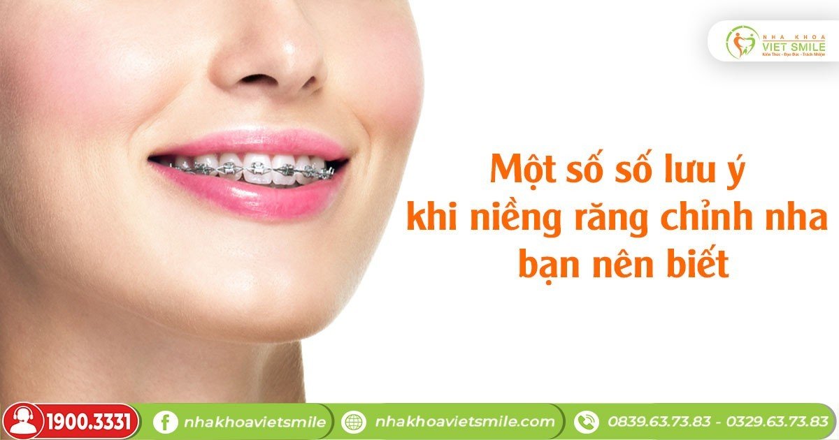 Một số lưu ý khi niềng răng chỉnh nha bạn nên biết