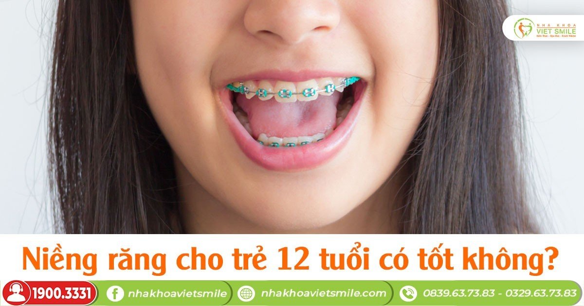 Niềng răng cho trẻ 12 tuổi có tốt không?