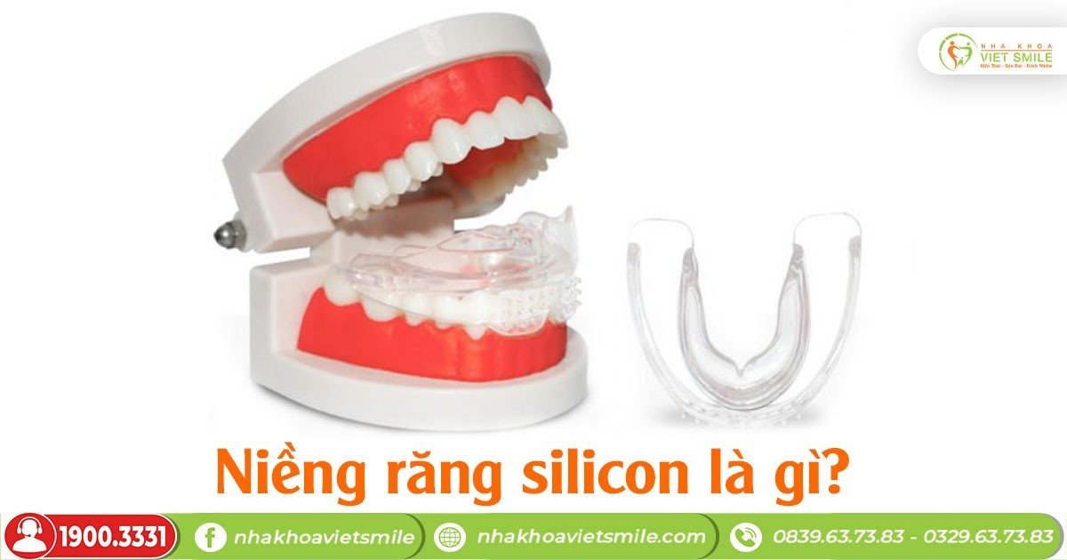 Niềng răng silicon là gì?
