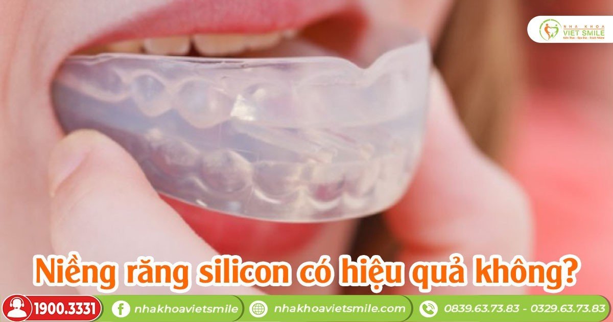 Niềng răng silicon có hiệu quả không?