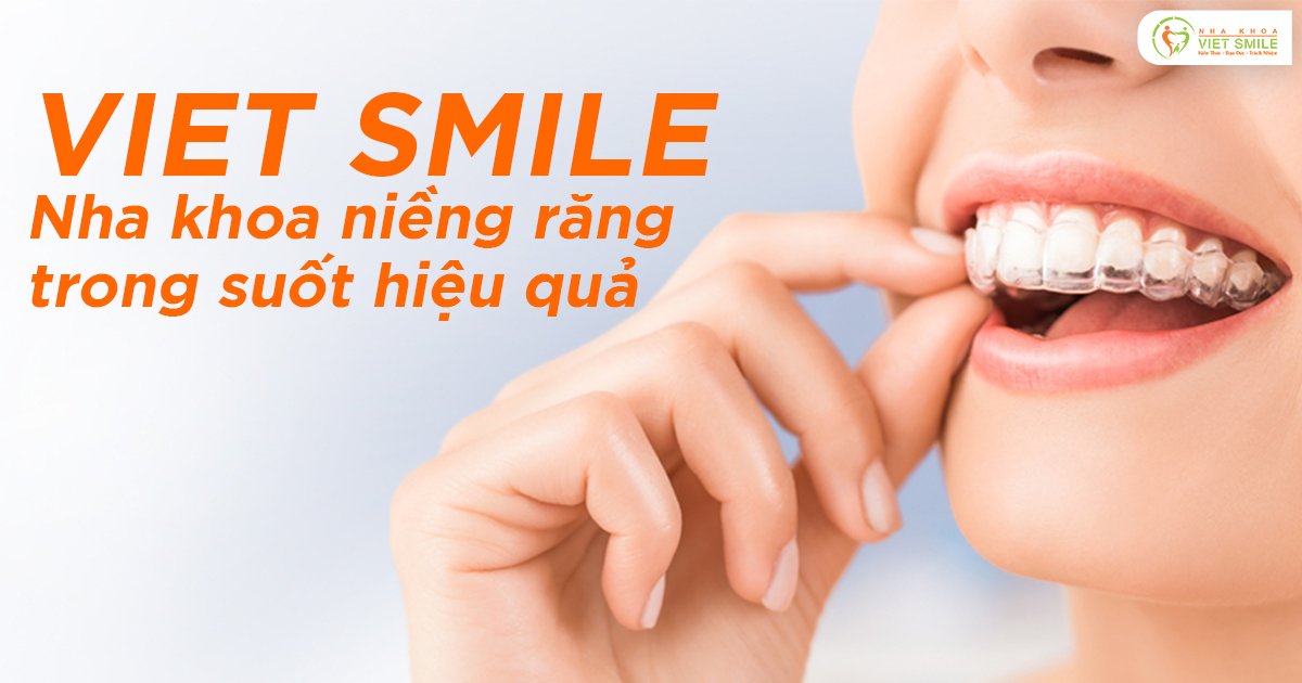 Viet Smile - Nha khoa niềng răng trong suốt hiệu quả