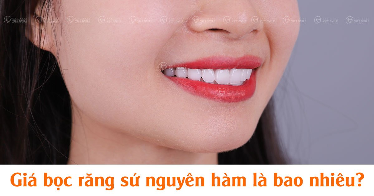 Giá bọc răng sứ nguyên hàm là bao nhiêu?