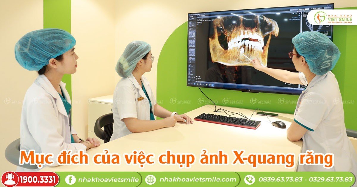 Mục đích của việc chụp ảnh X-quang răng