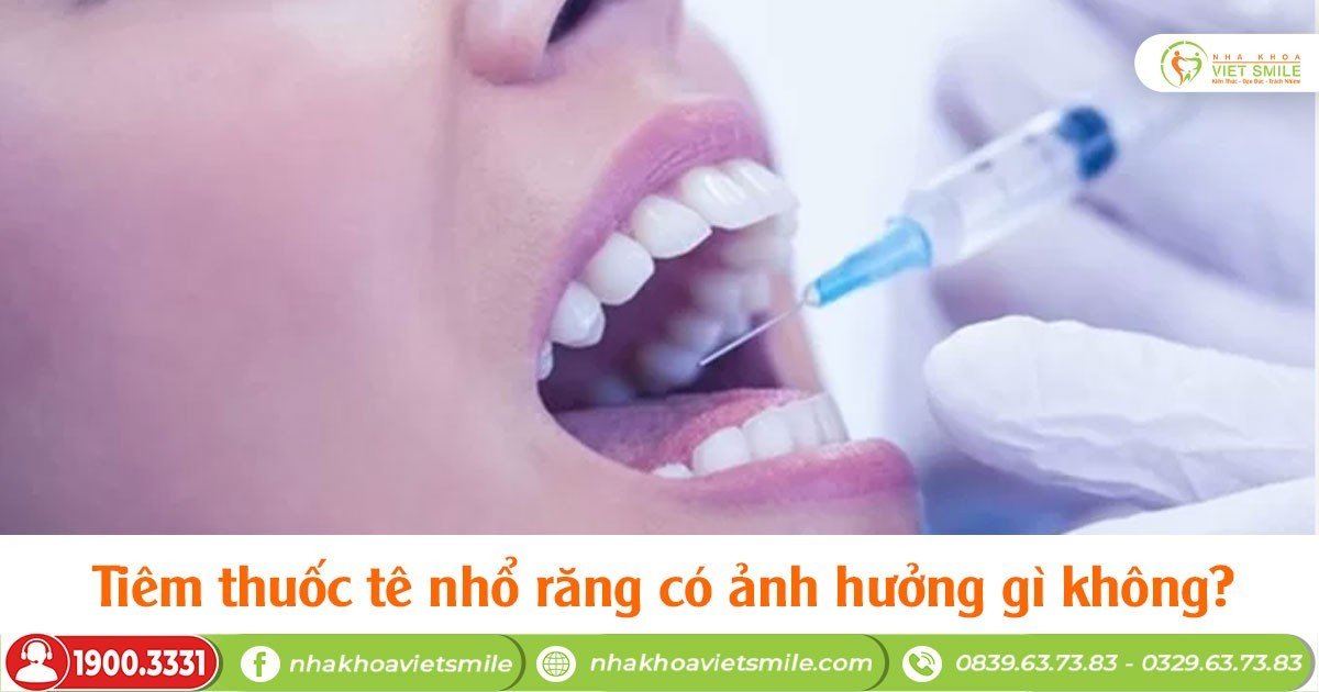 Tiêm thuốc tê nhổ răng có ảnh hưởng gì không?