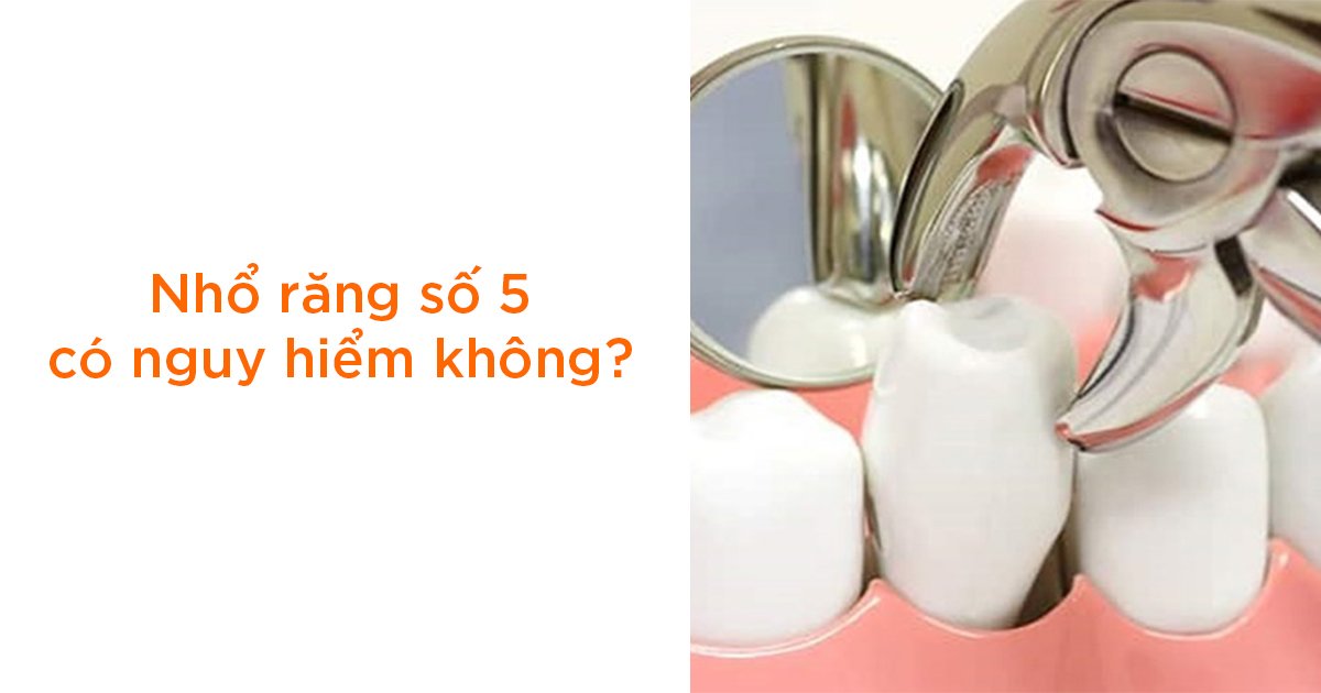 Nhổ răng số 5 có nguy hiểm không?